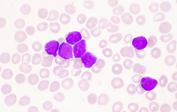 Μέτριο βλαστικό κύτταρο λευκών αιμοσφαιρίων σε κηλίδες αίματος.. - Φωτογραφία, εικόνα