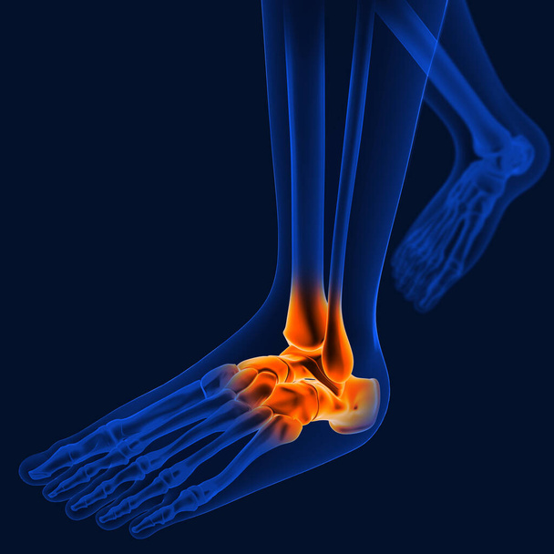Біль у суглобах може бути викликана травмою, що вражає будь-які зв'язки, бурсаї або сухожилля, що оточують суглоб
. - Фото, зображення