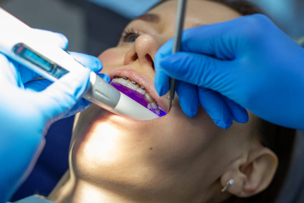Žena se zubními rovnátky chodí na kliniku k zubaři. v zubním křesle během instalace rovnátek na horní a dolní zuby. Zubař a asistent pracují společně, mají v rukou zubní nástroje. koncepce  - Fotografie, Obrázek