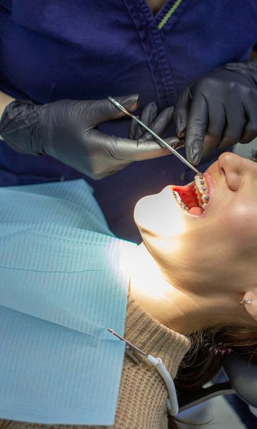 Una donna con l'apparecchio dentale visita un ortodontista in clinica, su una sedia dentale. durante la procedura di installazione dell'arco di bretelle sui denti superiori e inferiori. Il dentista indossa i guanti e ha gli strumenti dentali in mano. Il concetto - Foto, immagini