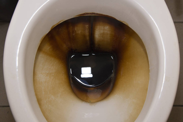 Fénykép egy nagyon koszos, higiénikus WC-ről, ami fehér volt, közelről. - Fotó, kép