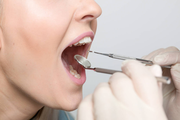 close-up van mond van vrouw bij onderzoek in de tandheelkunde / bij de tandarts - Foto, afbeelding
