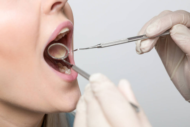 close up of mouth of woman at examination in dentistry / at the dentist - Foto, afbeelding