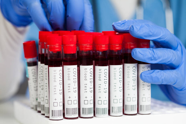 Laboratório ou técnico médico examinando amostras de sangue de pacientes com coronavírus COVID-19, vacutainers tubo de teste pronto para análise, reação em cadeia da polimerase (rRT-PCR) teste para detecção de SARS-CoV-2 - Foto, Imagem