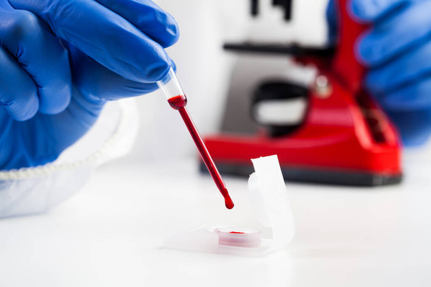 Scientifique de laboratoire ou technologue médical prélevant un échantillon de sang à l'aide d'un compte-gouttes de pipette d'un contenant, analyse d'échantillon de sang de patient COVID-19, épidémie mondiale de coronavirus et crise sanitaire - Photo, image