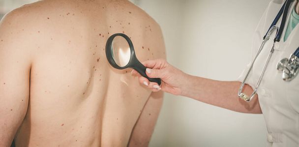Dermatologo che esamina la pelle sulla schiena di un paziente - Foto, immagini