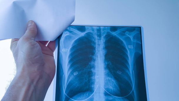 Ένας γιατρός ελέγχει το ακτινογραφικό φιλμ των πνευμόνων και της καρδιάς μιας γυναίκας ασθενούς σε ένα δωμάτιο νοσοκομείου. - Φωτογραφία, εικόνα