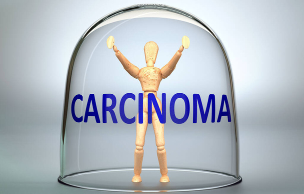 El carcinoma puede separar a una persona del mundo y encerrar en un aislamiento invisible que limita y restringe - representado como una figura humana encerrada dentro de un vaso con una frase Carcinoma, ilustración 3d - Foto, Imagen