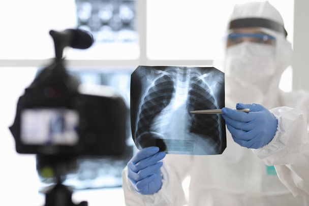 Arzt in Schutzanzug und Maske zeigt vor Kamera ein Röntgenbild. - Foto, Bild