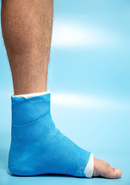 Tornozelo de tala azul. Perna enfaixada moldada no paciente masculino em fundo azul claro desfocado. Conceito de lesão esportiva. - Foto, Imagem