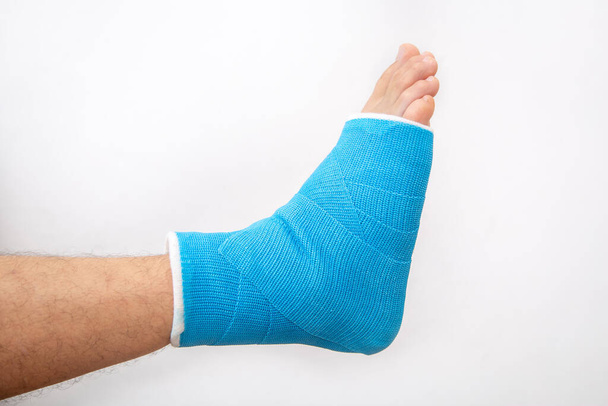 青い分割足首。白い背景に孤立した男性患者に包帯された脚をキャスト.スポーツ傷害の概念. - 写真・画像