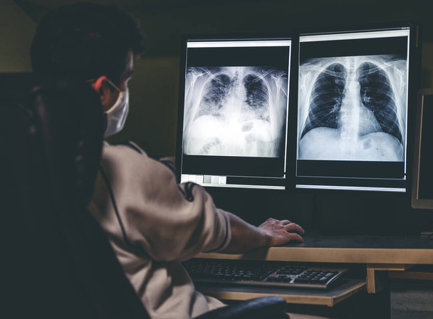Radiologist looking at x-ray image of lungs of patient with coronavirus Covid-19 on screen. - Photo, Image