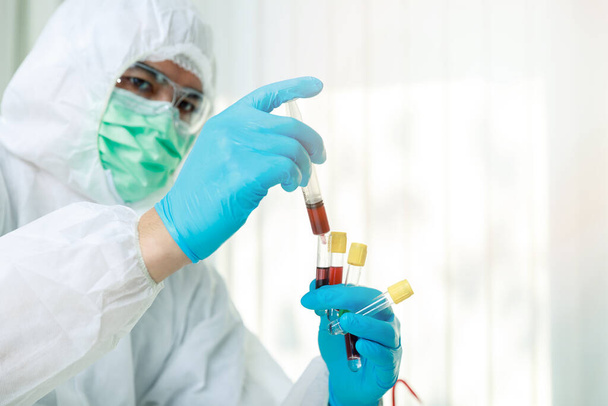 Investigador o científicos carga la muestra líquida en el tubo de ensayo en el laboratorio. Los investigadores están desarrollando vacunas y medicamentos para tratar el virus COVID-19. - Foto, imagen