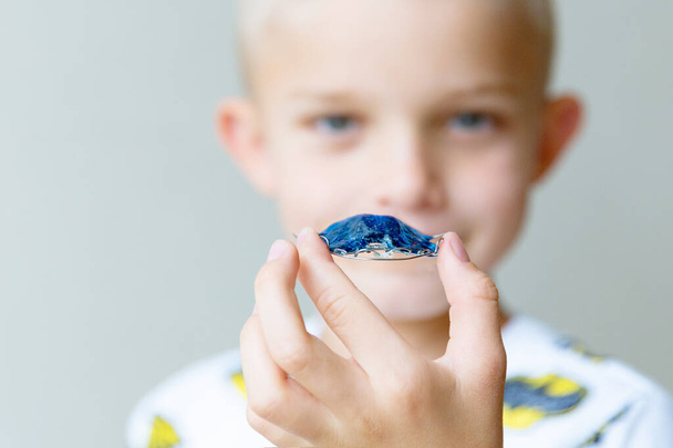 Un niño muestra una placa de ortodoncia infantil azul. El chico está fuera de foco. - Foto, imagen