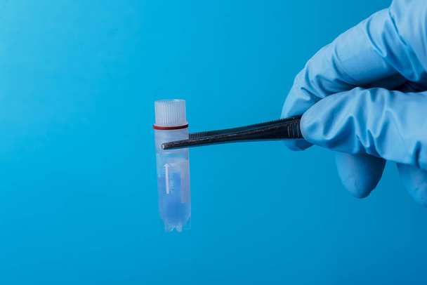 Laboratuvarda numunenin dondurulması. Bilim adamları test tüpünü tutuyor. Sperm ve yumurta içeren sıvı nitrojen bankası. Laboratuvarda Corona virüs testi. - Fotoğraf, Görsel