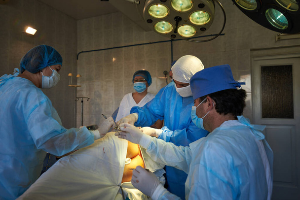 Χειρουργείο. Η νοσοκόμα δίνει το στήριγμα της βελόνας στον χειρουργό. Ιατρική παρέμβαση. - Φωτογραφία, εικόνα