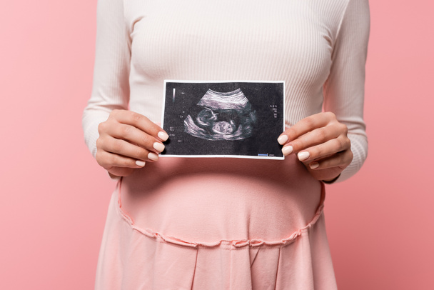 cropped view of pregnant woman holding ultrasound scan isolated on pink - Foto, Imagem