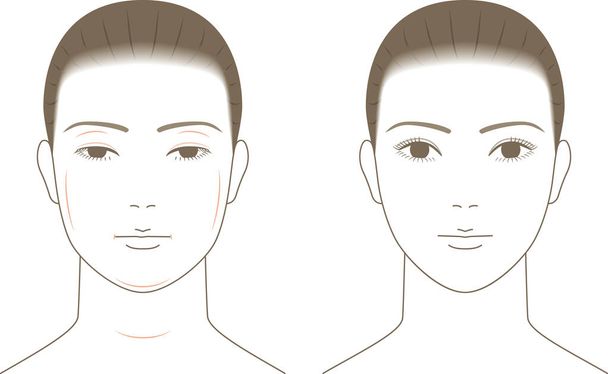 A woman with a swollen face. Beauty - Vector, Image