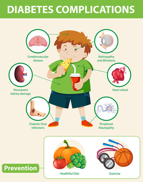 Infografía médica de complicaciones y prevención de la diabetes ilustración - Vector, imagen