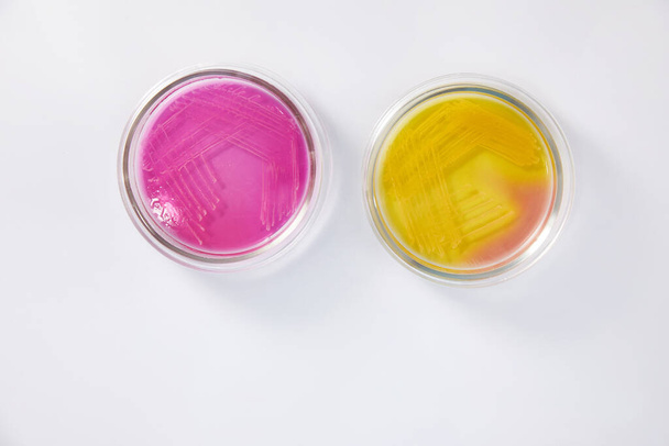 Лаборатория микробиологии. Чашки Петри с различными образцами бактерий - Фото, изображение