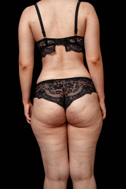 young woman in underwear. rear view . buttocks with cellulite and excess weight. on a black isolated background. concept for medicine and cosmetology. - Fotografie, Obrázek