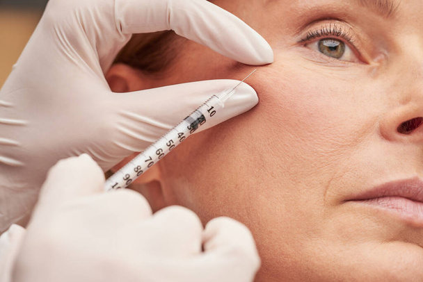 Cosmetologia anti-envelhecimento. Close up de uma mulher madura caucasiana recebendo injeção cosmética em sua bochecha - Foto, Imagem