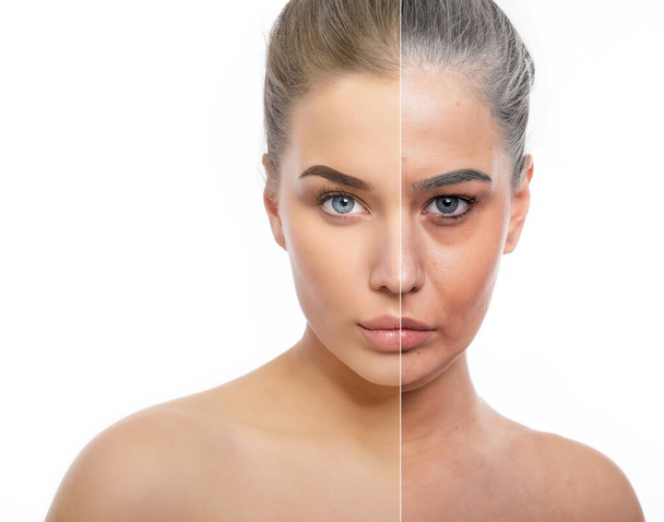 Beautiful fresh girl with young face and half face of old tired woman with wrinkles, dark circles, acne, comedones and and gray hair. Anti-aging, beauty treatment, aging and youth, lifting, antiaging, skincare, hydration, plastic surgery concept.  - Foto, afbeelding