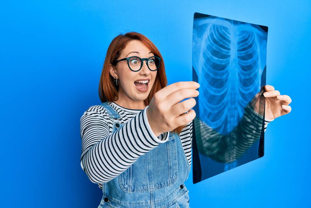 Beautiful redhead woman holding chest radiography celebrating crazy and amazed for success with open eyes screaming excited.  - Φωτογραφία, εικόνα