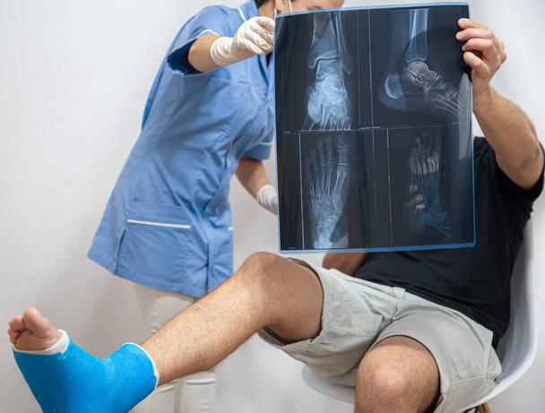 Ärztin im blauen Arztkittel erklärt einem Patienten mit gebrochenem Bein das Ergebnis einer Röntgenuntersuchung. - Foto, Bild