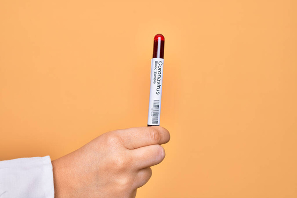 Hand of caucasian young woman holding tests tube with coronavirus results over isolated yellow background - Foto, imagen
