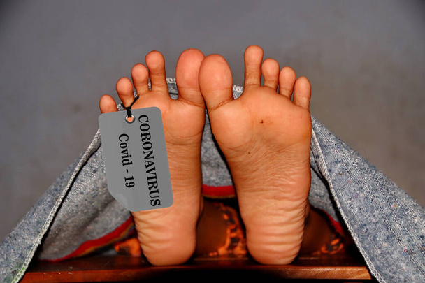 Nicht fokussiertes und lärmendes Bild, Konzeptimitat Leichenhalle, Coronavirus-Opfer von 2019-ncov getötet, Beine einer Leiche auf einem Tisch, Menschen gestorben - Foto, Bild