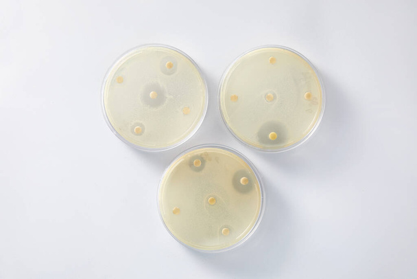 Mikrobiologisches Labor. Petrischalen mit verschiedenen Bakterienproben - Foto, Bild