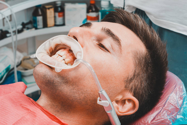 Zabieg u dentysty, dentysty przygotowuje pacjenta i narzędzia do usunięcia tataru, wyrzutnika śliny i zwijacza w jamie ustnej.2020 - Zdjęcie, obraz