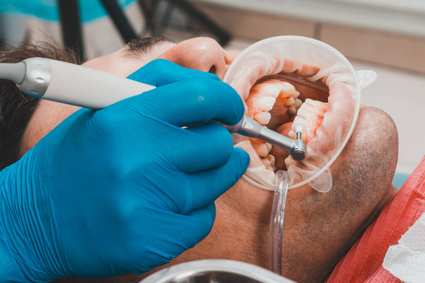 ασθενής αφαίρεση ταρτάρ, ο οδοντίατρος χρησιμοποιεί υπερηχογράφημα για να αφαιρέσει ταρτάρ, οδοντιατρική κλίμακα.2020 - Φωτογραφία, εικόνα