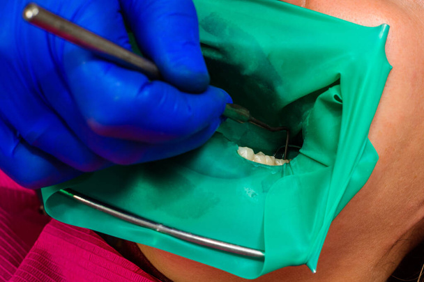 Стоматолог лікує зуб пацієнта гумовою греблею, дрилем, дзеркалом. 2020
 - Фото, зображення