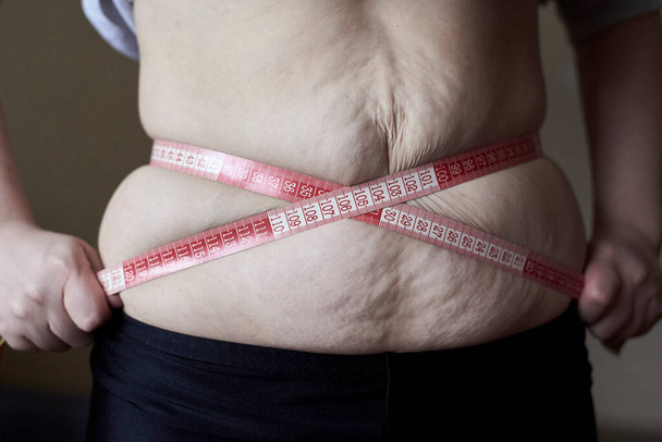 Жінка загорнула метр навколо жирового живота з розтяжками, темою втрати зайвої ваги, дієти та стресу
. - Фото, зображення