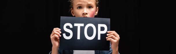Víctima de violencia doméstica con moretones en la mejilla que sostiene la tarjeta con letras de stop aisladas en negro, pancarta - Foto, Imagen
