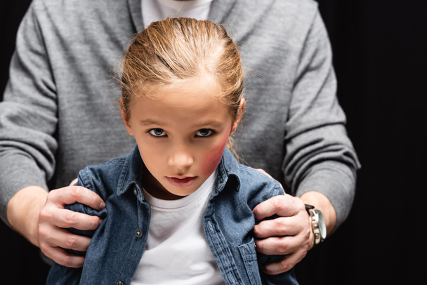 Criança com hematoma no rosto olhando para a câmera perto de pai abusivo em fundo borrado isolado em preto  - Foto, Imagem
