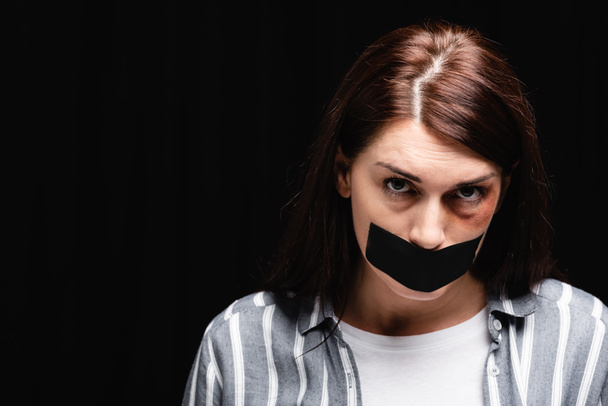 Slachtoffer van huiselijk geweld met blauwe plekken op gezicht en plakband kijkend naar camera geïsoleerd op zwart  - Foto, afbeelding