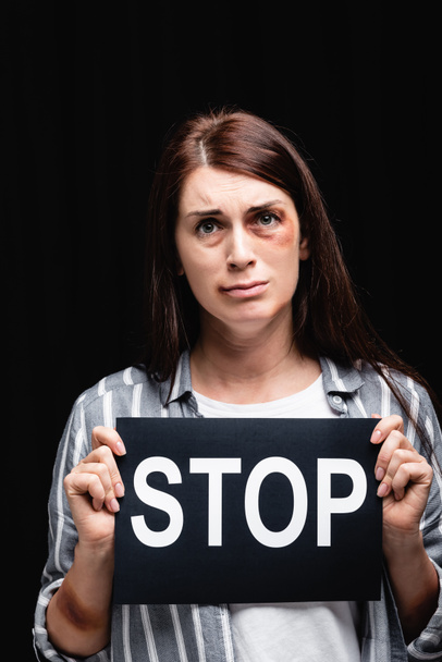 Mujer deprimida con moretones en la mano y la cara que sostiene la tarjeta con letras de stop aisladas en negro  - Foto, Imagen