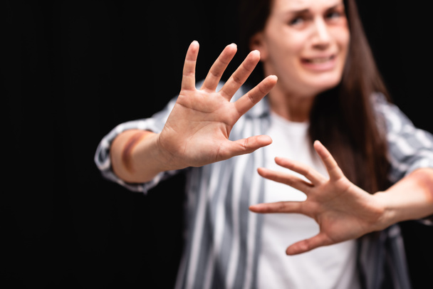 Žena s modřinami na rukou ukazuje žádné gesto na rozmazaném pozadí izolované na černé  - Fotografie, Obrázek