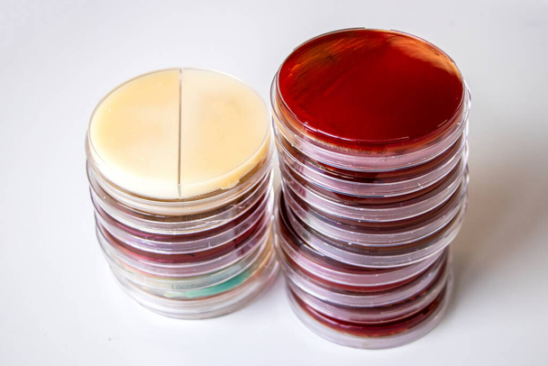 Στοίβα από πετροειδή πιάτα στο τραπέζι του εργαστηρίου μικροβιολογίας - Φωτογραφία, εικόνα