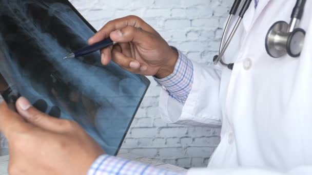 doctor analizando la fotografía de rayos X de cerca - Imágenes, Vídeo