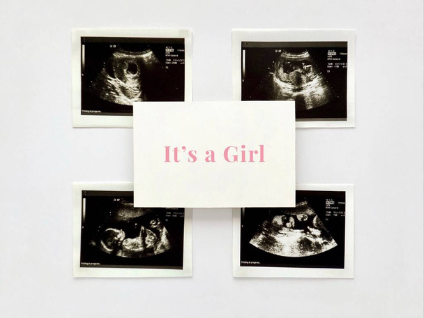Ultrahangos felvételek egy terhes nőről, fehér könyv szöveggel. Egy lány. - Fotó, kép