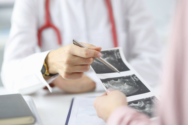 Doctor demonstrates results of ultrasound to patient. - Fotografie, Obrázek