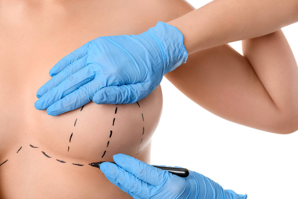 Arzt zeichnet vor kosmetischer Operation vor weißem Hintergrund Markierungen auf der weiblichen Brust - Foto, Bild