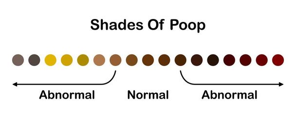 Human feces color. Shades color of poop. Normal and abnormal value scale. Healthy concept. Vector - Vector, Image