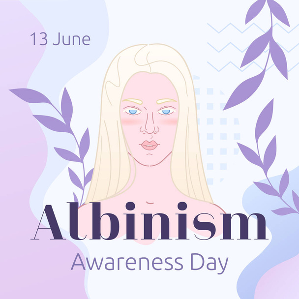 Journée mondiale de sensibilisation à l'albinisme. Bannière de salutation avec belle fille albinos. - Vecteur, image