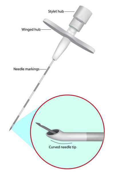 Tuohy Epidural Needle. Epidurální podání - Vektor, obrázek