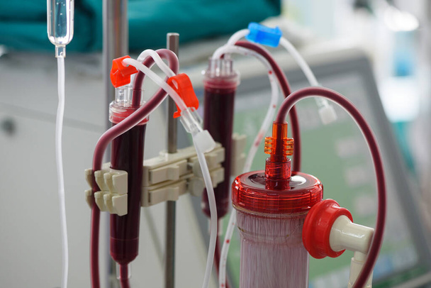 Vue rapprochée du matériel d'hémodialyse pour insuffisance rénale en unité de soins intensifs - Photo, image